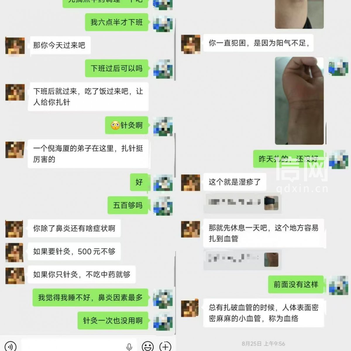 伍医生与费女士曾线上沟通，称无证行医医生为倪海厦弟子，同时解释了针灸部位淤青是因为湿疹和扎了血管。（来源：受访者）