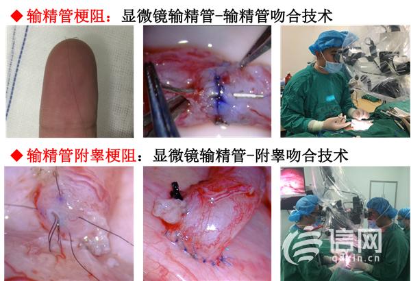 青大附院男性科坚持规范化诊治大力推行日间手术