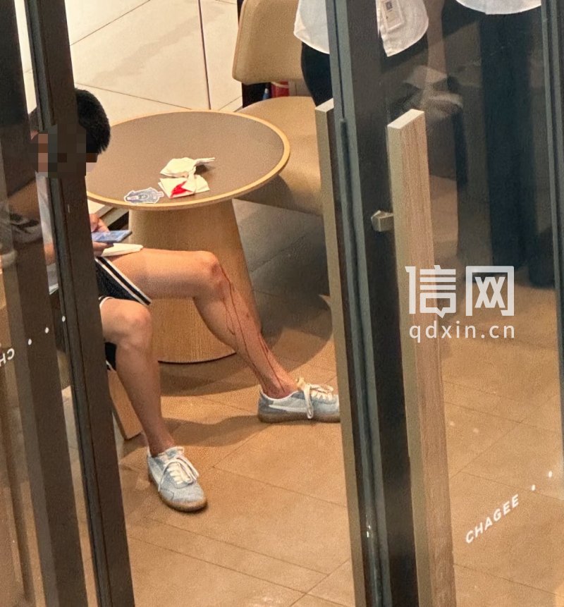 一名男青年腿部受伤流血。（来源：受访者）
