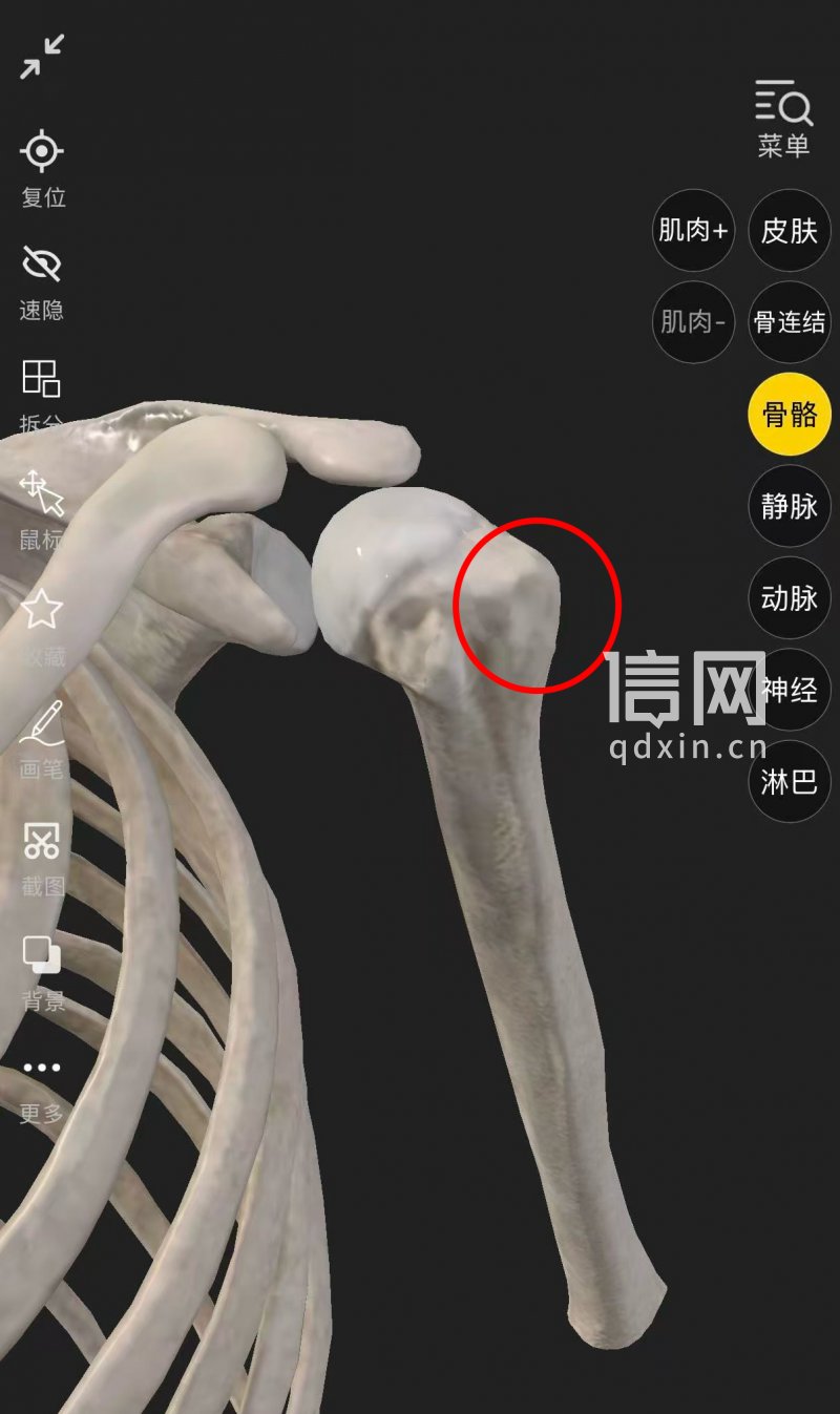 王大夫提供了相关图例，说明肱骨大结节的具体位置。（来源：专业软件）